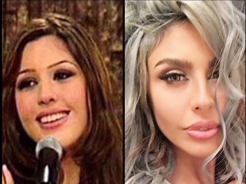 إستعادت الفنانة ليلى اسكندر ذكريات في برنامج ستوديو الفن بصورة سببت مفاجأة لجمهورها، حيث بدت بشكل مغاير تماماً عما تبدو عليه حالياً، حيث كشفت الصورة عن حجم عمليات التجميل التي خضعت لها، حتى غيرت ملامحها ولون بشرتها تماماً.