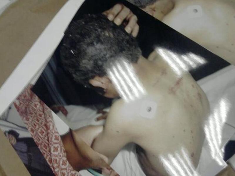 Shocking: images of torture victims, this one of a tortured minor found on the state security premises amongst files.