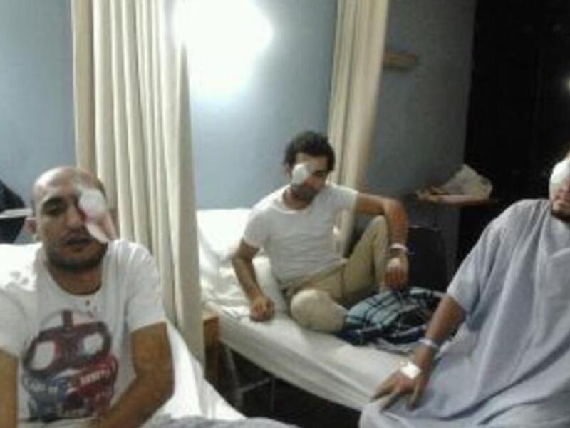 As people flooded the iconic square that inspired other Arab squares since to aspire to feats as freedom, the media lens
shifted back to this deja-vu scene of people power. But those in power now, SCAF were plainly abusing their authority,
issuing orders to target heads. Personnel could be heard receiving orders to aim for protesters' 
eyes. 