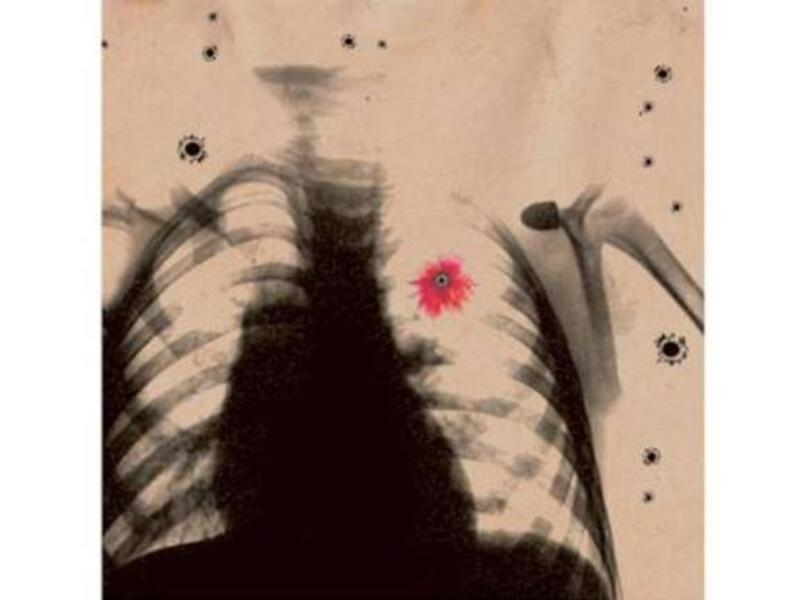 The Syrian artist says his works are a way of voicing his pain