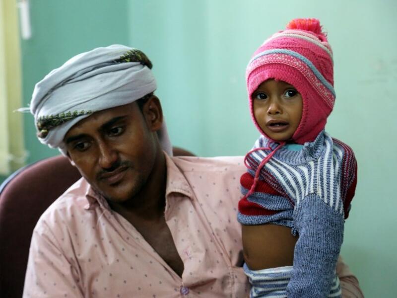 A Yemeni father carries his child suspected of being infected with cholera, as he waits to be seen at a hospital in the Yemeni coastal city of Hodeidah on November 5, 2017. (Abdo Hyder/AFP)