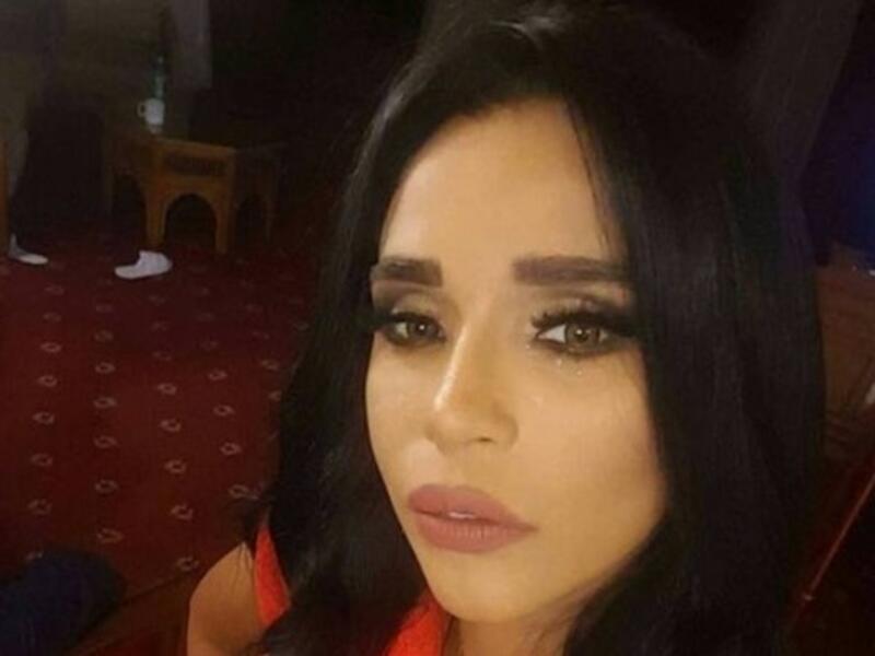 نشرت الفنّانة أمينة صورة جديدة لها على “إنستغرام” أظهرت تبدلاً كبيراً في ملامحها إذ أشارت تعليقات المستخدمين إلى امكانية اجرائها عمليات تجميلية وأطلّت أمينة في الصورة بشكل جديد تماماً إذ ارتدت عدسات لاصقة باللون العسلي بينما ظهرت شفتاها وكأنهما خضعتا للحقن.