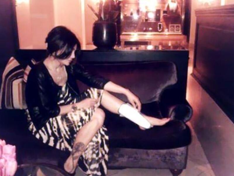 Haifa showing her injured foot