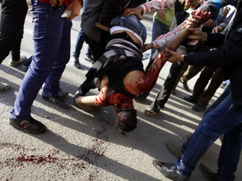 Egyptian protesters carry their gravely injured comrade during clashes with riot police near Tahrir Square in Cairo on March 9, 2013. Two protesters were killed in the clashes in Cairo --one from bird shot and one from suffocation. (AFP PHOTO / MAHMOUD KHALED)