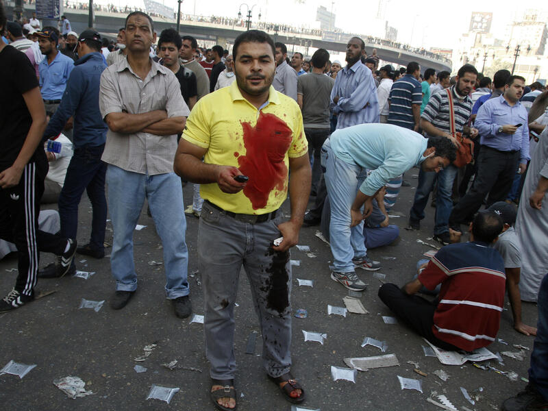 A supporter of the Muslim Brotherhood and Egypt's ousted president Mohamed Morsi stands in a blood-stained shirt as demonstrators gather in Cairo's Abbassiya neighbourhood (AFP/MOHAMMED ABDEL MONEIM)