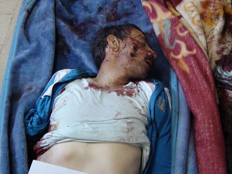 A  man who was allegedly killed in mortar attacks at Camp Liberty, an exile camp housing Iranian dissidents near the Iraqi capital Baghdad, on February 9. Assailants fired dozens of mortars and rockets at the camp in a dawn attack that killed five people, the first deaths from violence since they resettled near Baghdad last year. (AFP Photo/HO/Mujahedeen-e-Khalq)