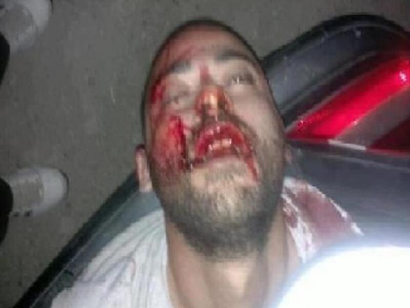 Mohammad Rafea covered in blood