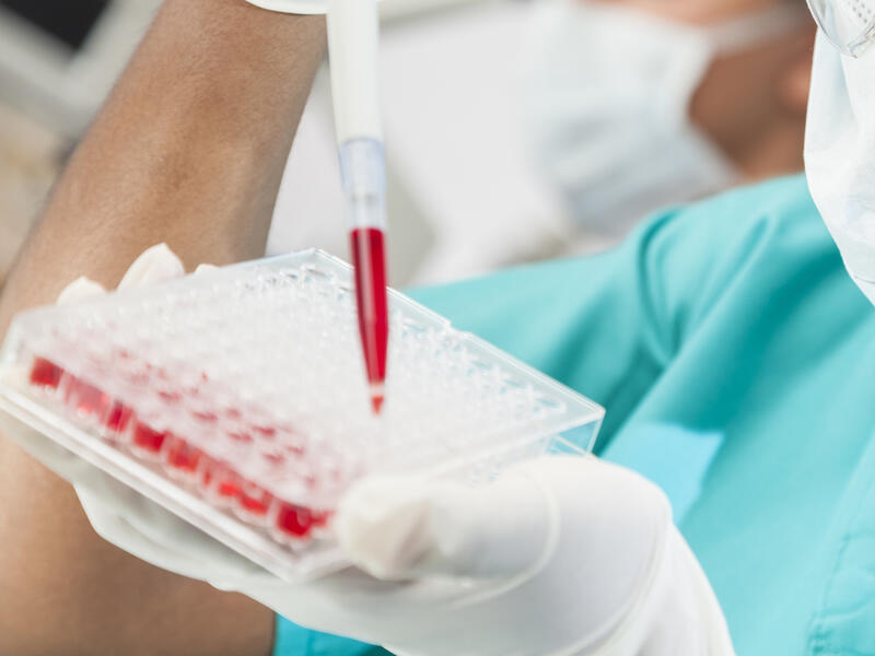 يتم انتقال المرض "الايدز"عن طريق الاتصال الجنسي على مستوى العالم هو بين طرفين من جنسين مختلفين ويتم ايضا من خلال التعرض لدم ملوث بالمرض او انتقال الفيروس من الأم الحامل لطفلها.