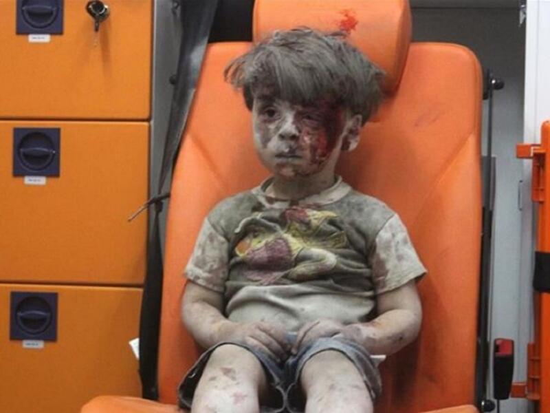 الطفل عمران (5 أعوام) تصدرت صورته وسائل الإعلام العالمية، وتم إنقاذه من تحت أنقاض أحد المباني المهدمة في المنطقة الشرقية لحلب في سوريا، وظهر عمران في الصورة شارداً مذهولاً وهو جالس على كرسي عربة الإسعاف.