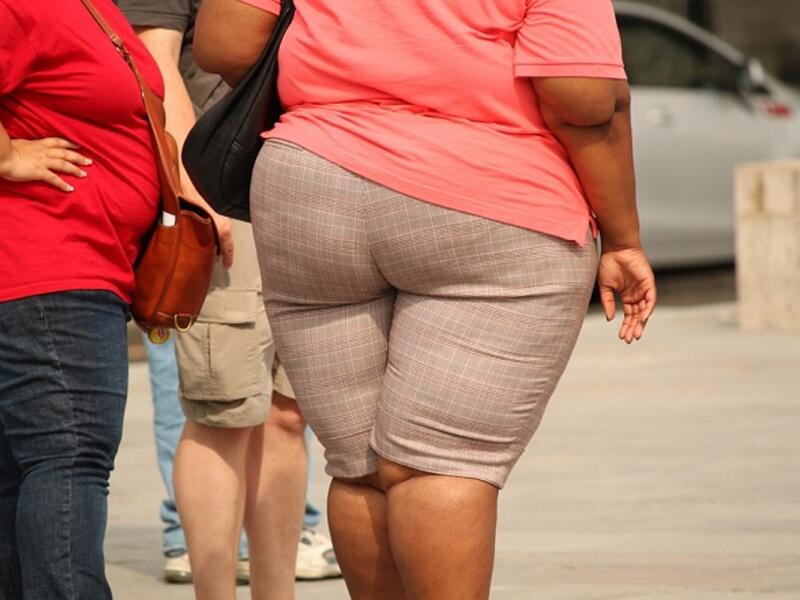 A recent report revealed that 70 percent of men and 75 percent of women suffer from obesity today, which is expected to be responsible for the deaths of over 500,000 people every year. (Pixabay)