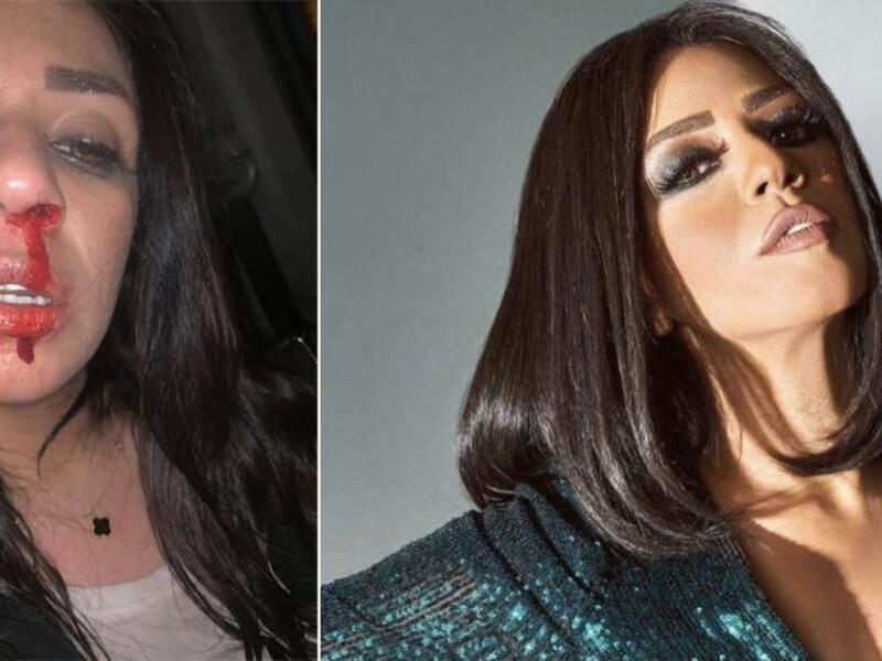أعلنت المطربة المصرية شاهيناز عن تعرضها للضرب من زوجها السابق إيهاب، بعد أيام من إعلان انفصالها عنه بعد زواج دام 3 سنوات.