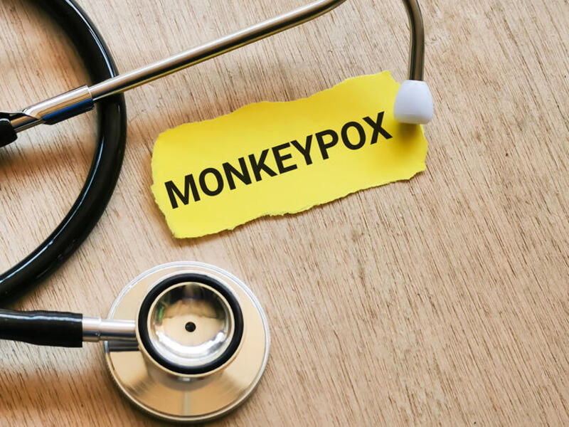 Man Diagnosed With First US Case of Monkeypox in 2022