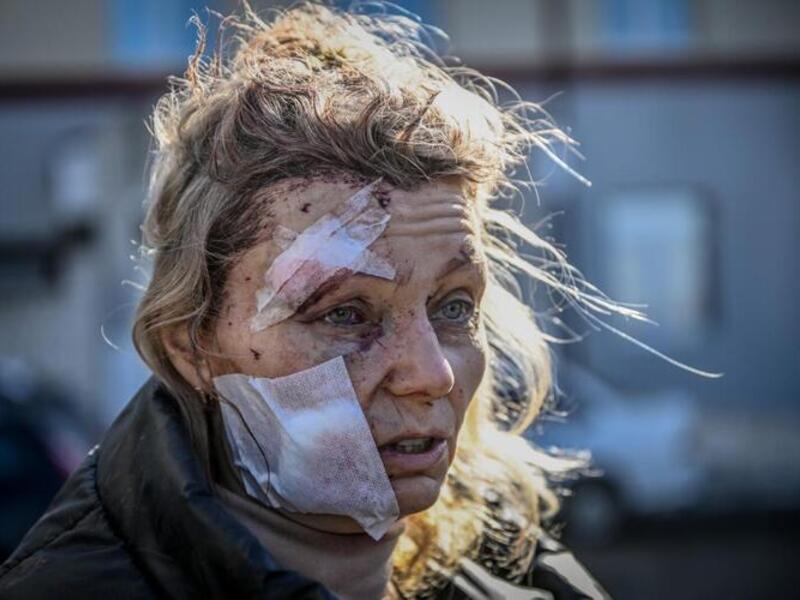 A Month On: Powerful Photos to Come Out of Ukraine