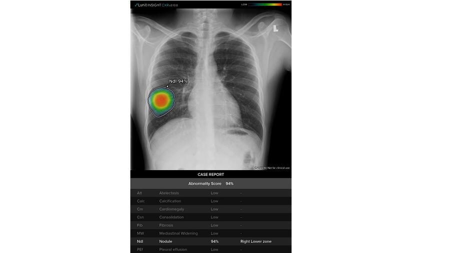 جنرال إلكتريك للرعاية الصحية تواصل تقديم التكنولوجيا المبتكرة لدعم المتخصصين في الرعاية السريرية في عالم يشهد تفشي وباء "كوفيد-19" اليوم