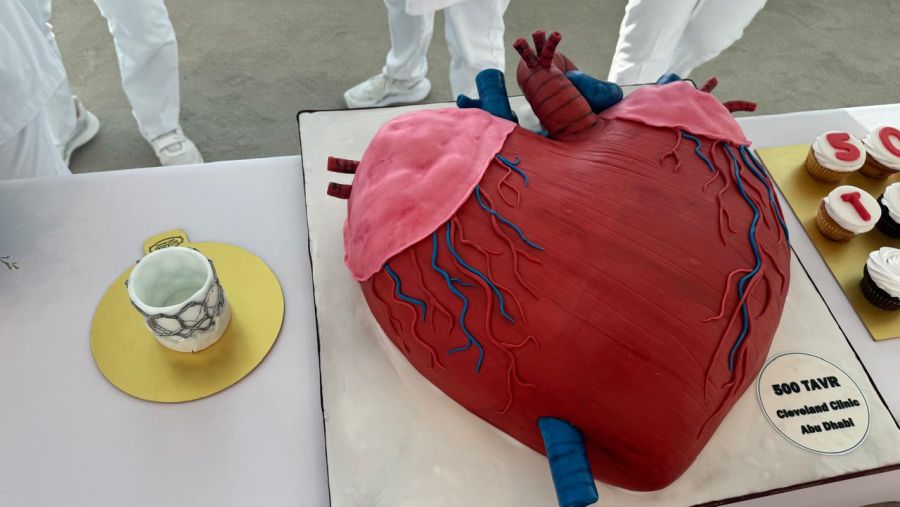 كليفلاند كلينك أبوظبي ينفذ 500 إجراء لزراعة الصمام الأبهري عبر القسطرة مرسخاً ريادته في رعاية أمراض القلب في دولة الإمارات