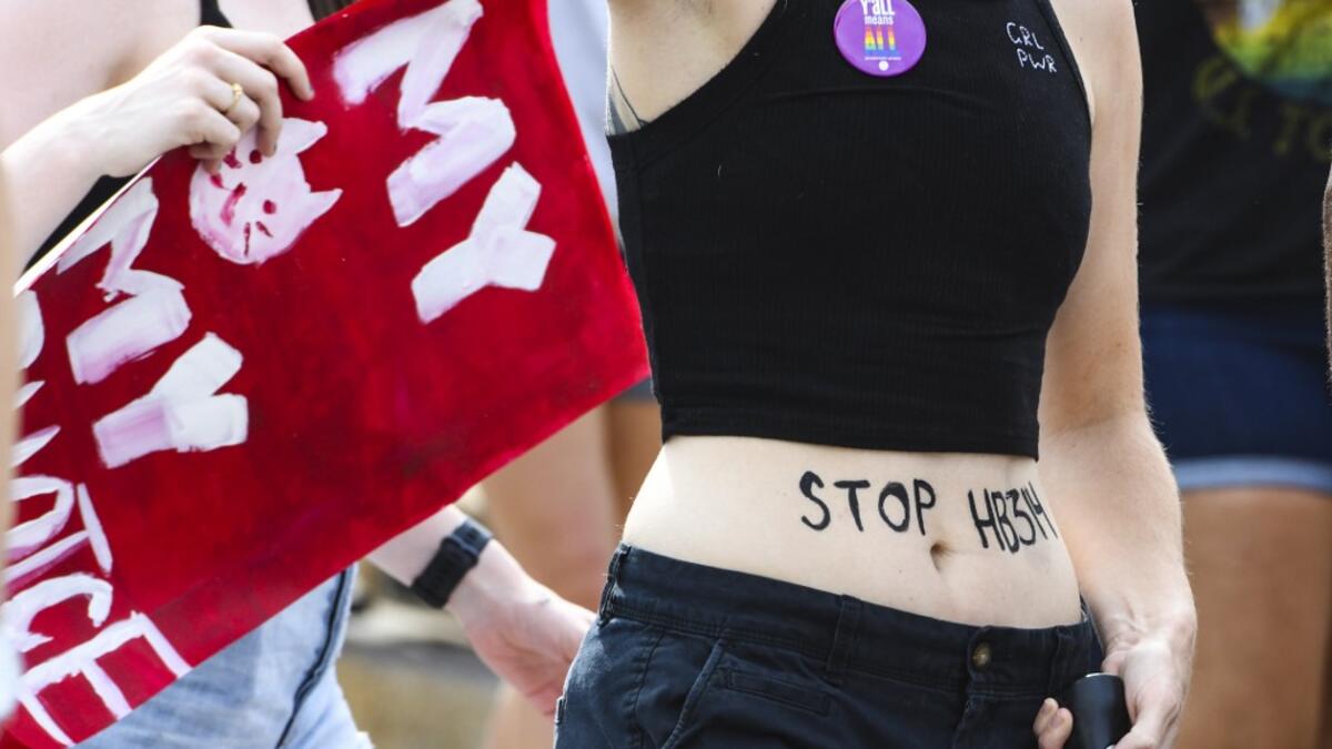 Demonstrators gathered to protest HB 314, a bill passed by the Alabama Legislature last week making almost all abortion procedures illegal. Julie Bennett/Getty Images/AFP