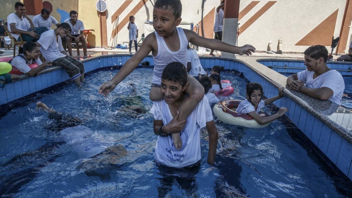 The PCRF is a non-governmental organisation providing physical and psychological services for disabled children in Gaza Strip. SAID KHATIB / AFP