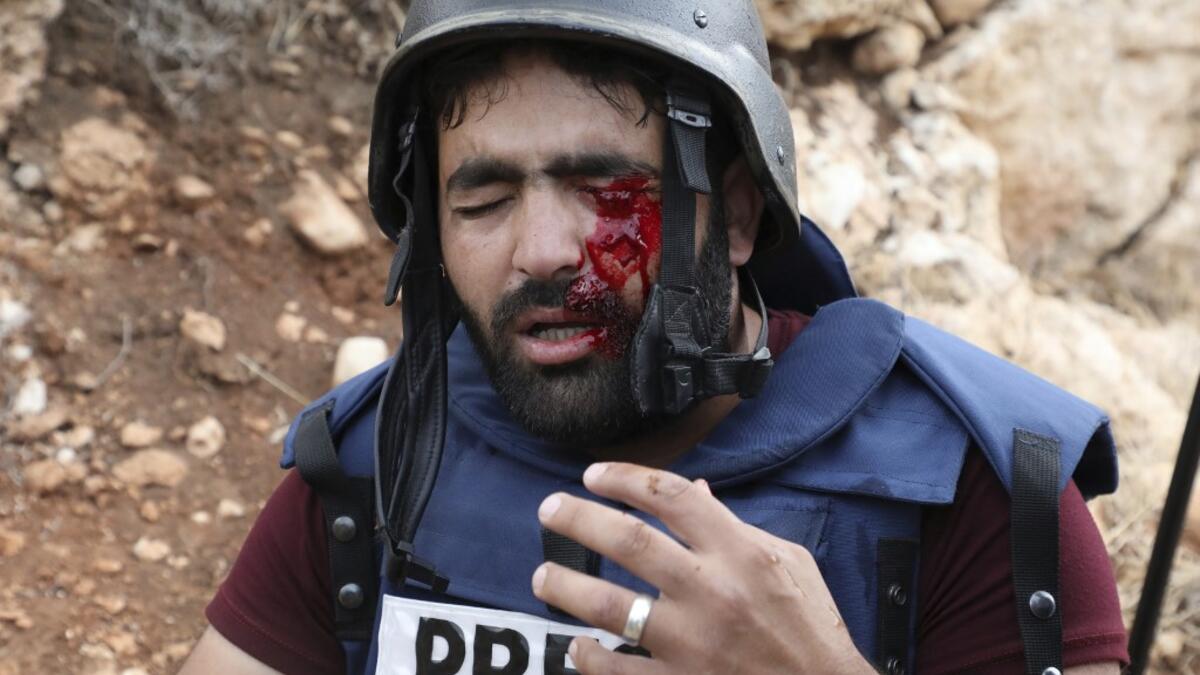 Palestinian cameraman Mu'ath Amarneh gestures after he was hit on the face by a rubber bullet from Israeli border police during clashes between Palestinians and Israeli security forces in the village of Surif northwest of the West Bank town of Hebron on November 15, 2019. HAZEM BADER / AFP