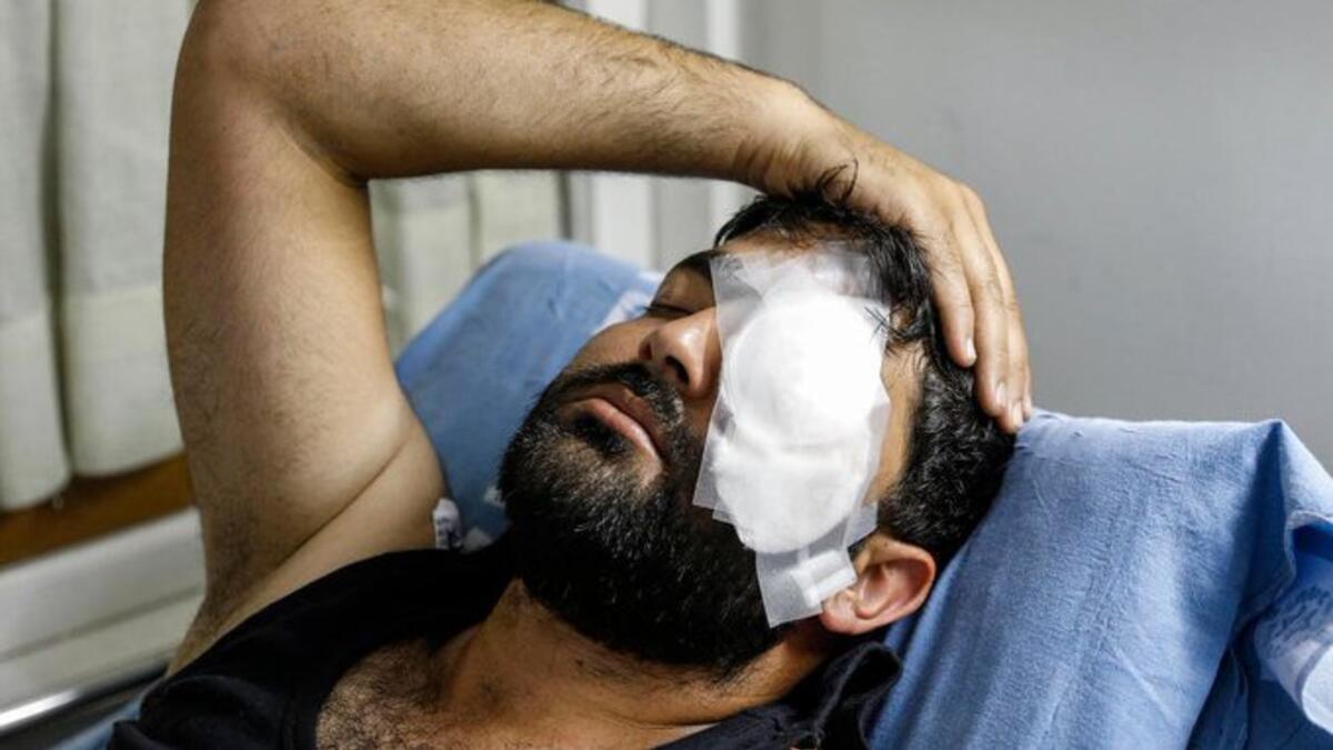 Palestinian photojournalist Muath Amarneh lost his left eye yesterday by Israeli sniper fire while covering protests in Surif near Al-Khalil (Hebron)(Twitter)