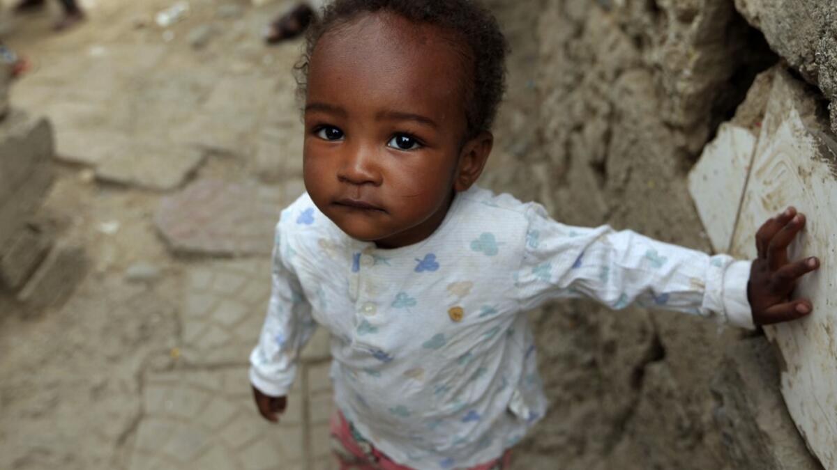 A child of Yemen's minority group known as "Muhamasheen" -- literally the "Marginalised" is pictured at a slum in the capital Sanaa on July 4, 2020. At a time when the Black Lives Matter movement is reshaping societies, black Yemenis have scant hope for an end to centuries of discrimination that has only worsened during the civil war. In Sanaa, members of the minority group known as "Muhamasheen" live in dismal conditions in densely populated slums. They count among the poorest of the poor in the Arab world