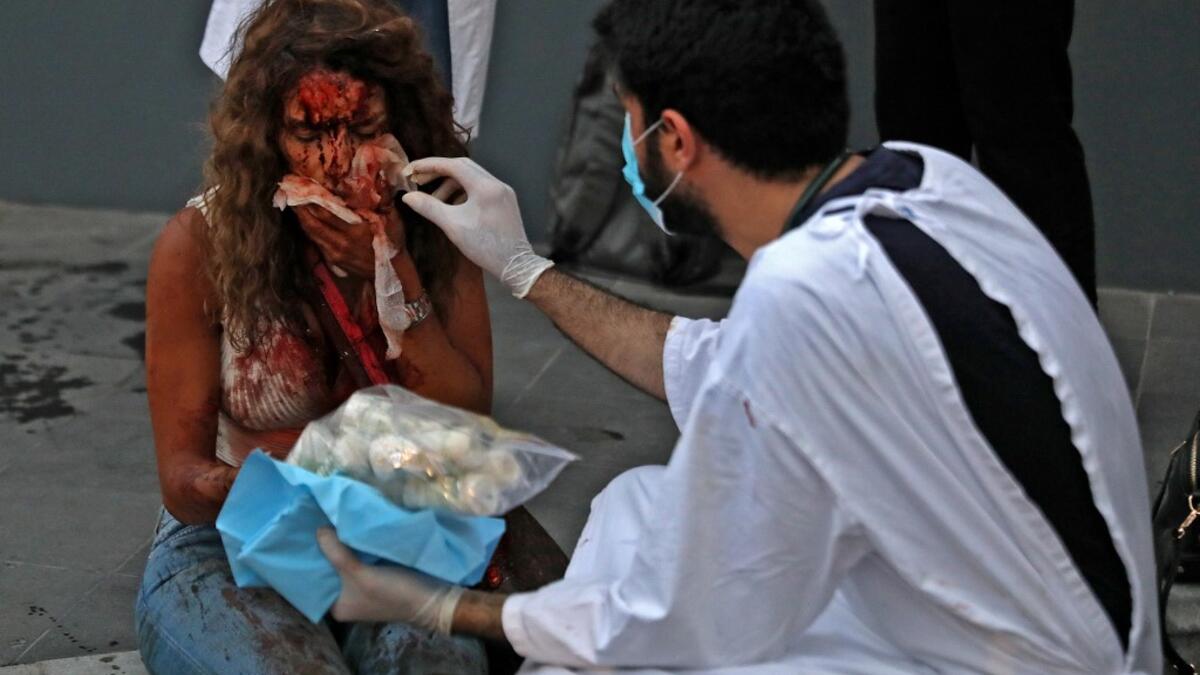 A wounded woman receives help outside a hospital following an explosion in the Lebanese capital Beirut on August 4, 2020. Two huge explosion rocked the Lebanese capital Beirut, wounding dozens of people, shaking buildings and sending huge plumes of smoke billowing into the sky. Lebanese media carried images of people trapped under rubble, some bloodied, after the massive explosions, the cause of which was not immediately known.  IBRAHIM AMRO / AFP