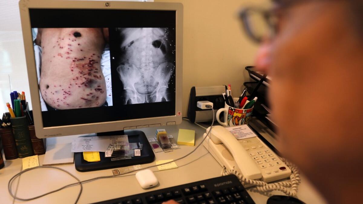 Lebanese doctor Selim Nasser displays the image of a patient's body. ANWAR AMRO / AFP