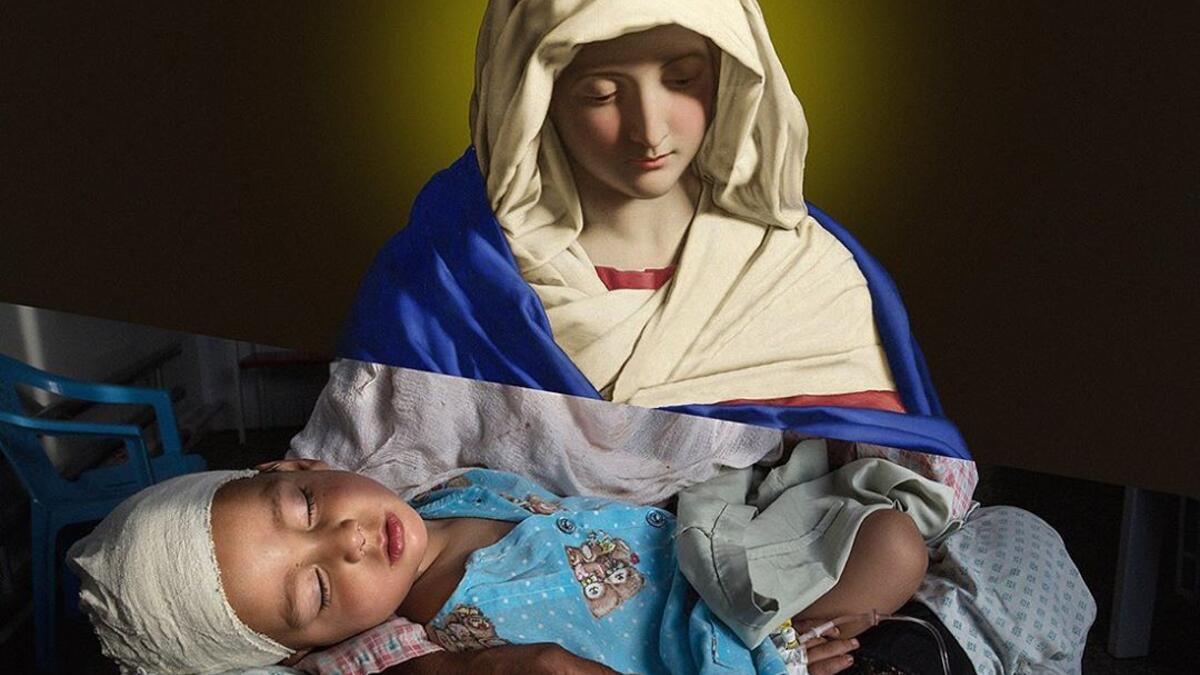 At the Emergency hospital Najiba holds her nephew Shabir, age 2, who was injured from a bomb blast which killed his sister in Kabul on March 29, 2016. Najiba had to stay with the children as their mother buried her daughter. (ugurgallen/ Instagram)