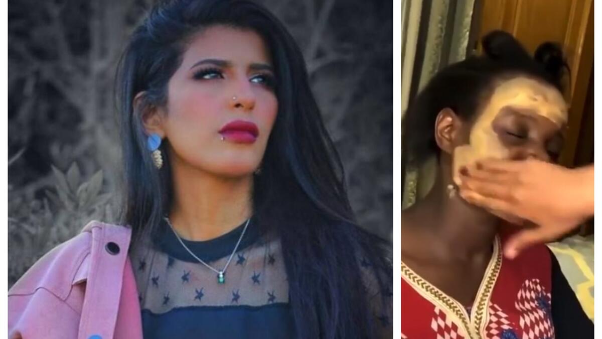 الناشطة اليمنية أروى عمر:  ظهرت في فيديو مع العاملة المنزلية وهي تضع كريم الأساس "فاونديشن" فاتح اللون كي تخفي لون بشرتها، وقالت: رح ندعكة ورح يصير بيضا بيضا".