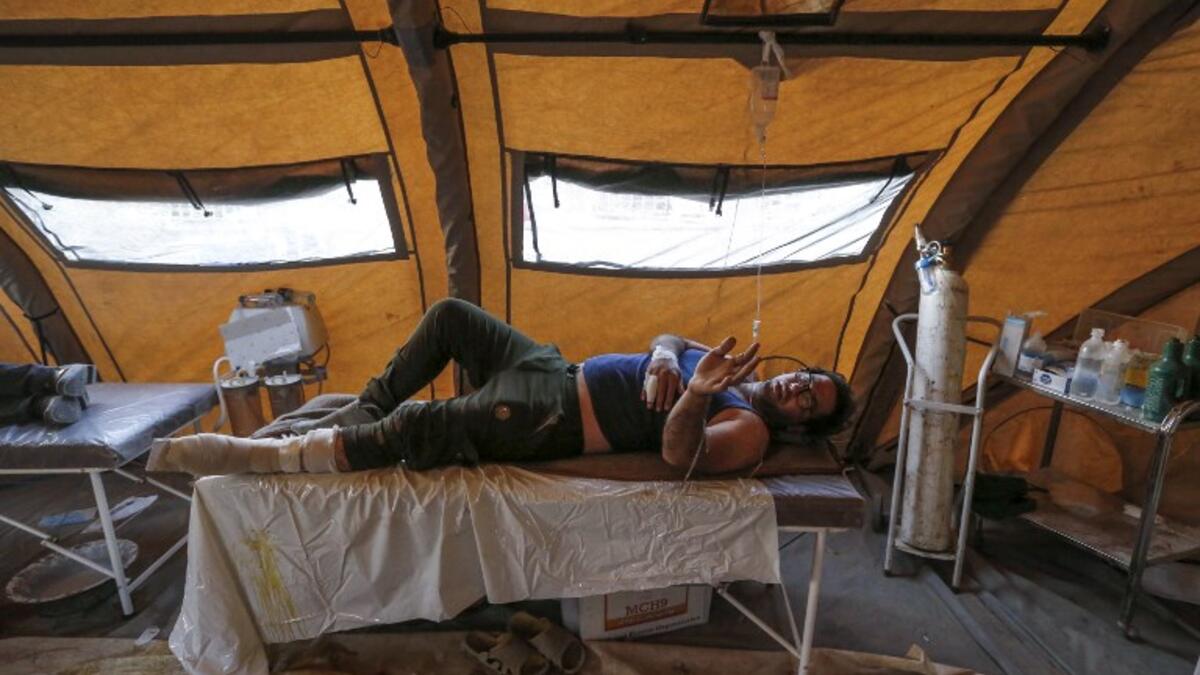 An Iranian quake victim lies on an operating bed after receiving treatment at a field hospital.

(ATTA KENARE / AFP)