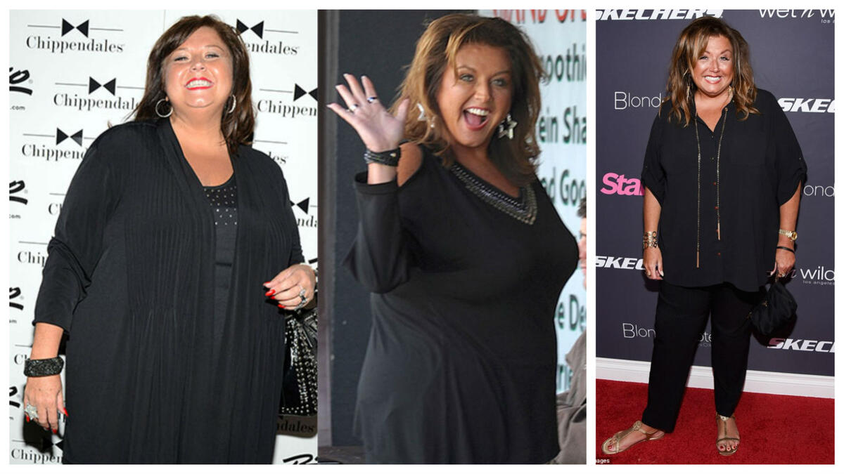 خسرت مصممة الرقصات الأمريكية الشهيرة "آبي لي ميلر" 45 كيلوغرامًا بعد أن خضعت لعملية "تكميم المعدة" عام 2017