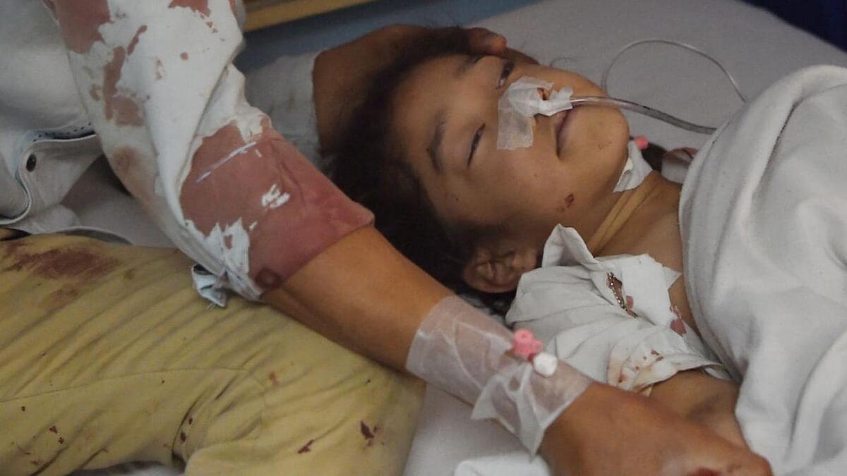 An 8-year-old Afghan treated in hospital after the suicide bombing. (AFP)