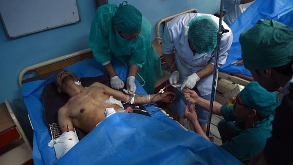 A wounded Afghan resident is treated following a suicide bombing attack at the Istiqlal Hospital in Kabul on April 22, 2018. (AFP Photo/ Wakil Koshor)