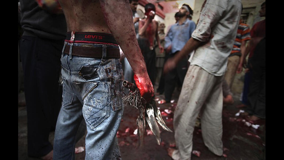 تبعا للشيعة فإن الحسين يشفع للمسلمين وهذا يعطي الحسين رضي الله عنه وظيفة المخلص المباشر للأبد من خلال معاناته وآلامه وتضحيته بنفسه وهذه التضحية بالنفس تذكرنا بعقيدة صلب المسيح في المسيحية مع الاختلاف في الهدف.