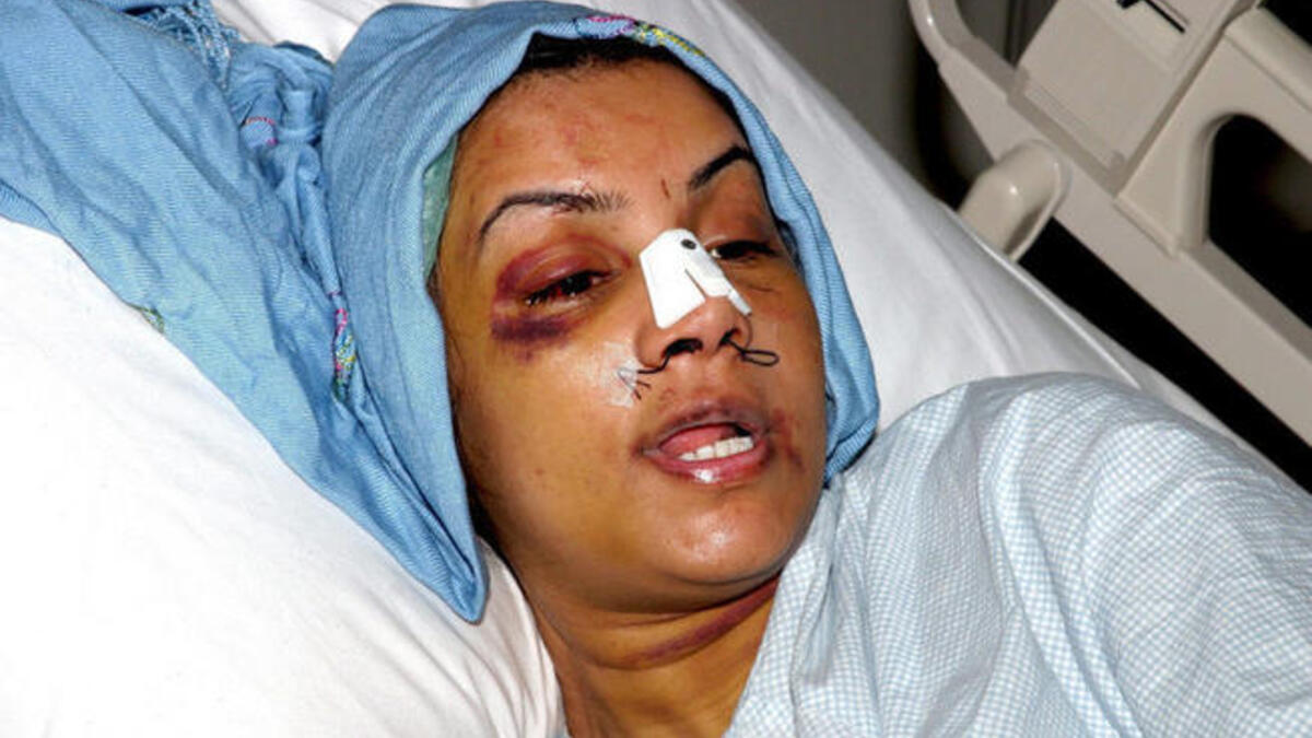 ‘Thank God we live in America': Oprah caused an upset in the Arab world, during an interview with battered Saudi Arabian wife Rania al-Baz, who in 2005 showed her face to Oprah & the world. Saudis objected that this face did not represent the average Saudi woman who lived a well-treated life.