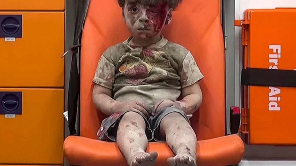 Damned if you stay, damned if you go: A young Syrian boy sits injured in the back of an ambulance after being pulled from the rubble by civil defense workers following a reported government airstrike in eastern Aleppo.