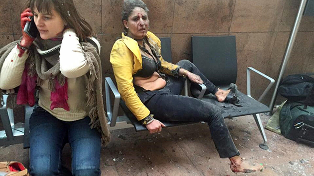 Bombings strike Brussels: Nidhi Chaphekar, a flight attendant, sits injured and in shock in the aftermath of the bombing at Brussels Airport. The three bombings, claimed by Daesh, killed 32 and injured more than 300.