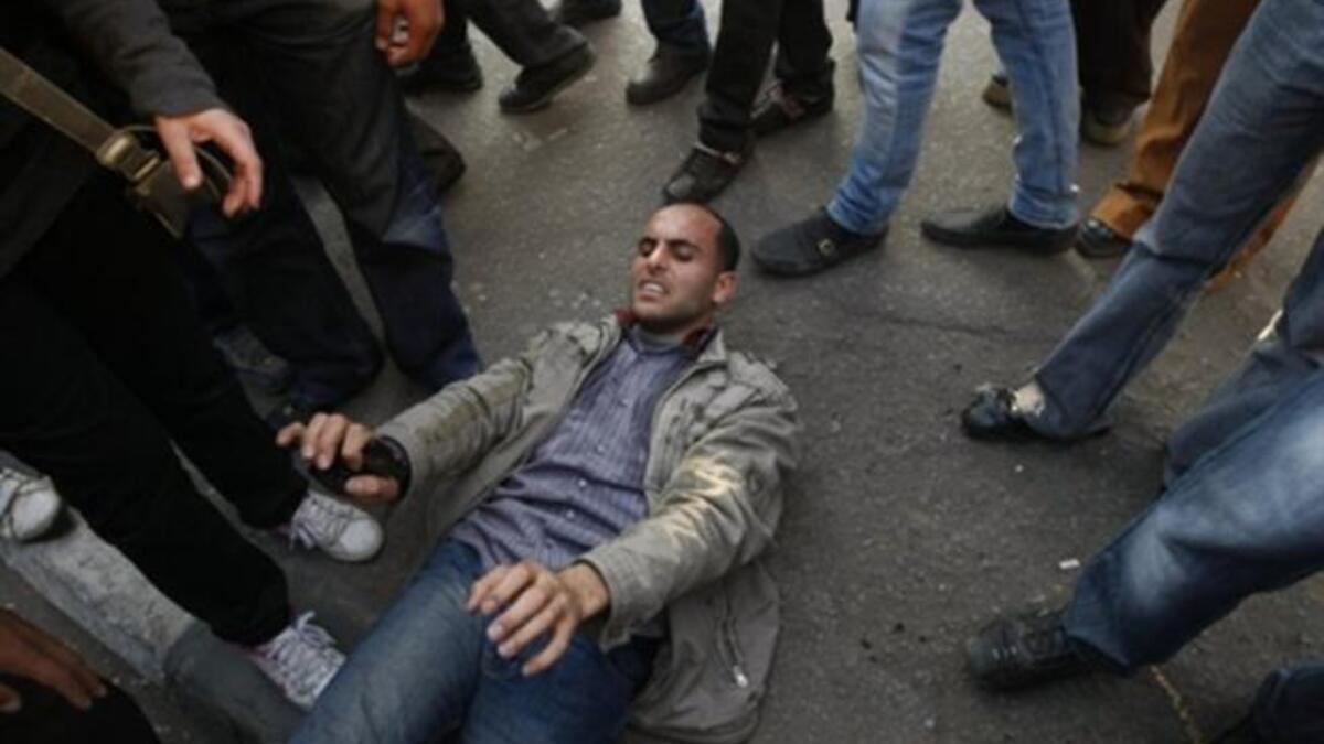 A wounded Egyptian demonstrator lies on the ground during clashes with Egyptian police.