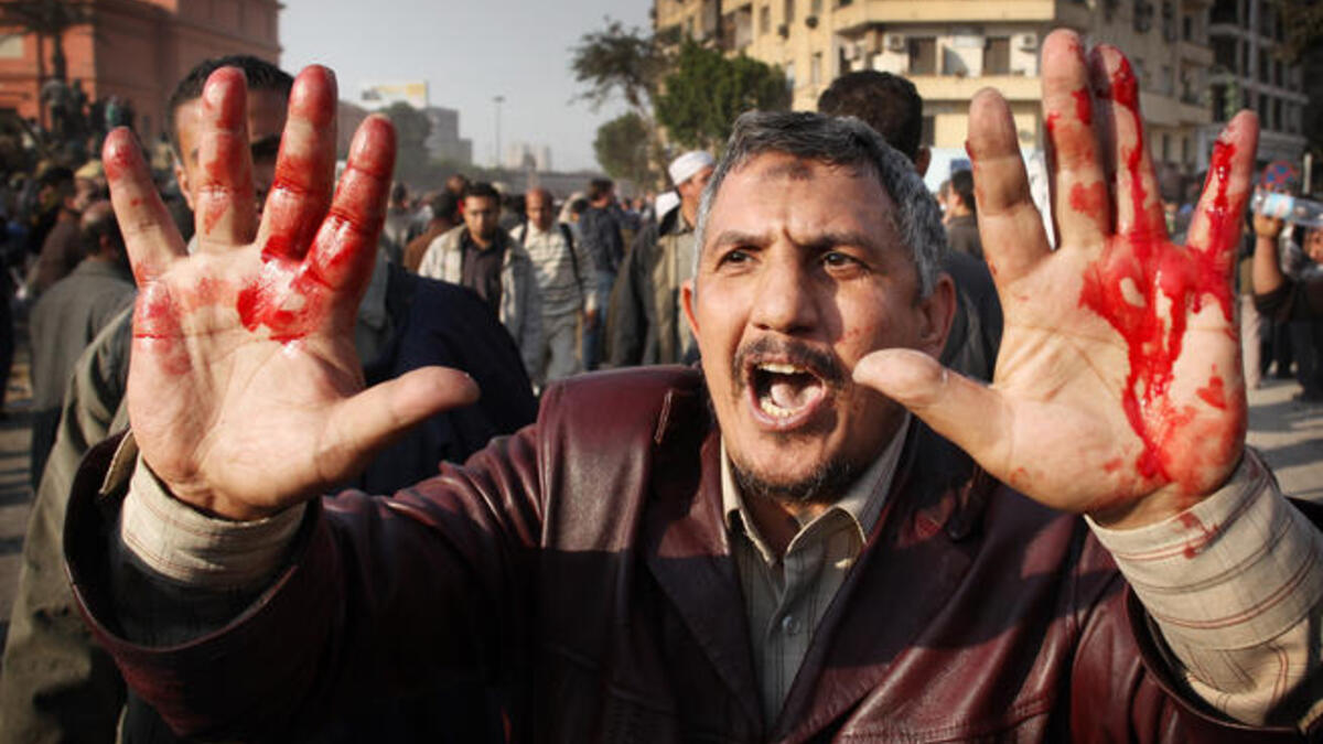 An anti-government protestor shows blooded hands from an injury received during clashes with supporters of President Mubarak in Tahrir Square.