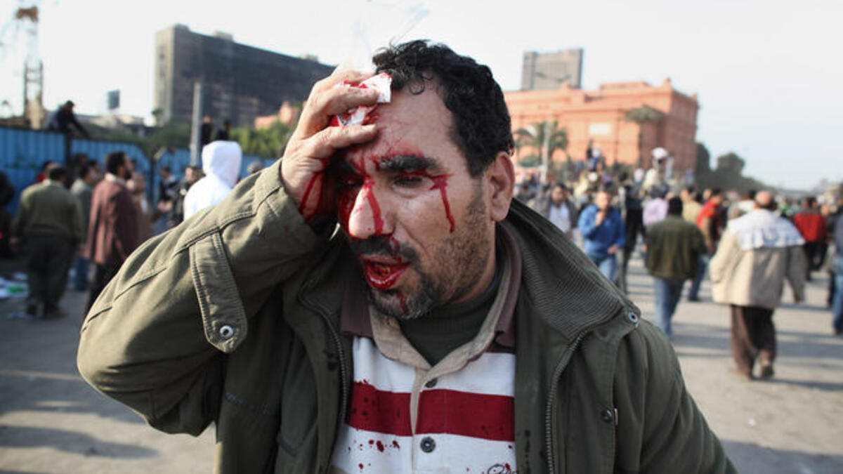 An anti-government protestor holds a cloth to his head injury after clashes with supporters of President Mubarak in Tahrir Square.