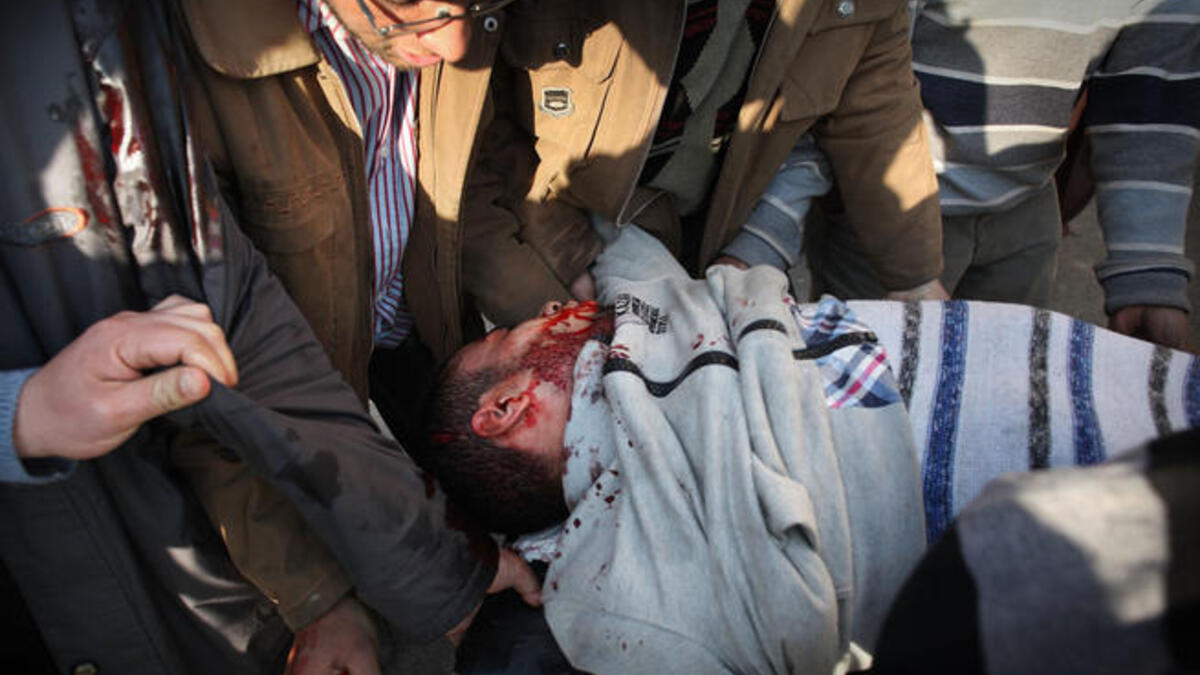 Anti-government protestors carry an injured man.