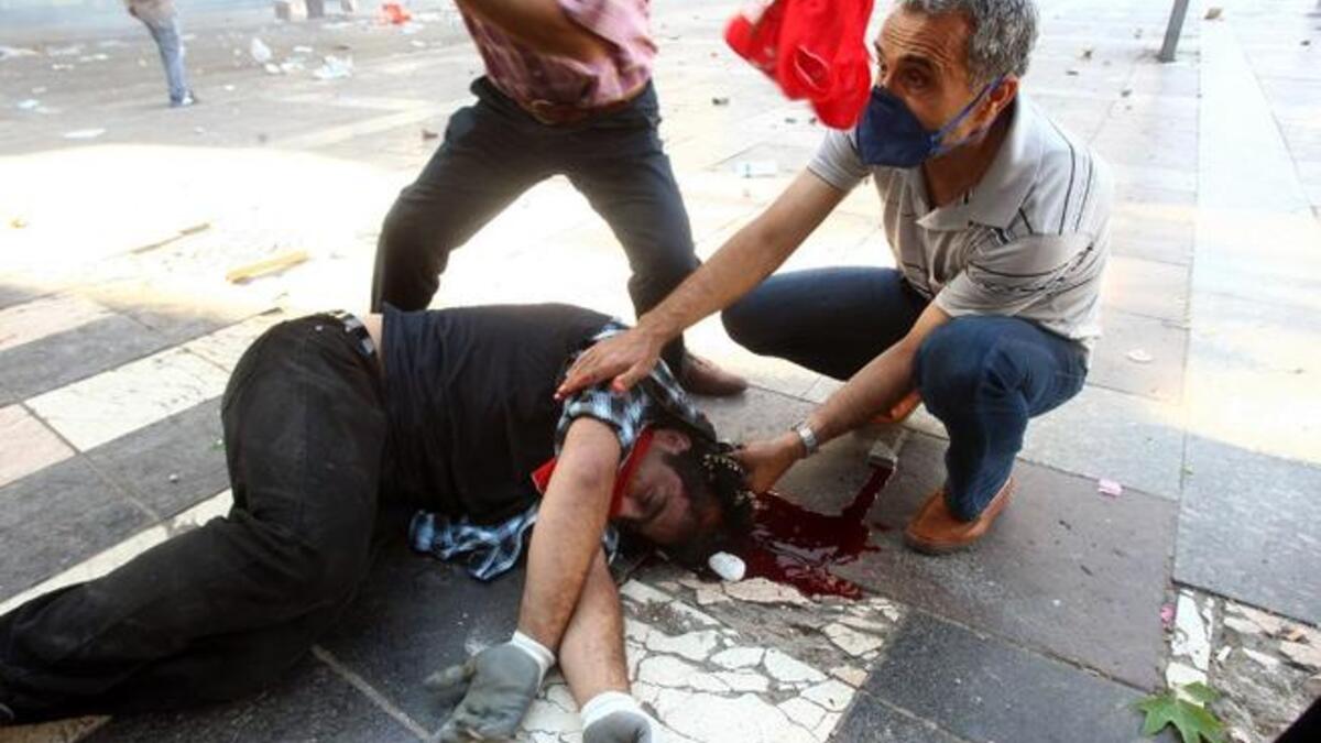 man severely wounded