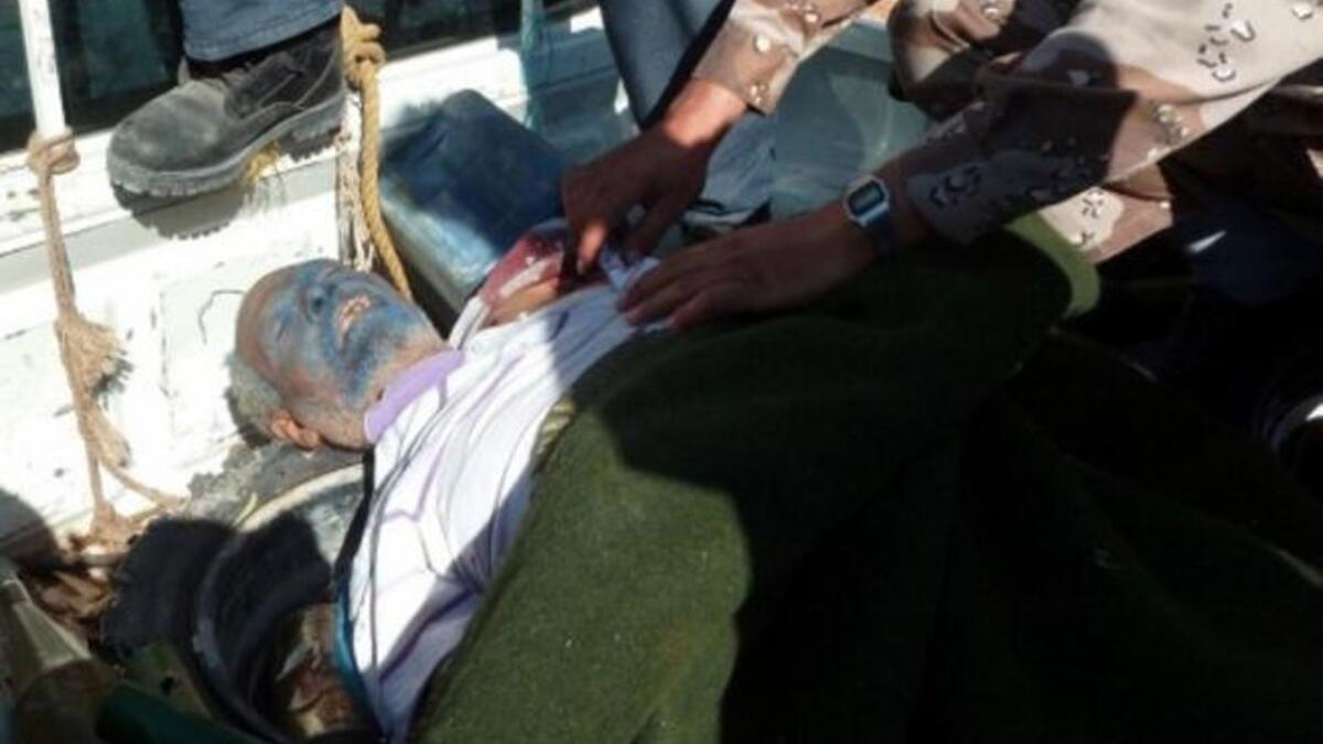 The face of death: We are now accustomed to seeing death up close and personal, since Saddam Hussein,Osama Bin-Laden and the "watch the dictator die" trend came into fashion. Here is the defaced corpse of Abubaker YunesJaber, former defence minister under Muammar Gaddafi's regime, in Sirte, captured and killed alongside Veteran rulerGaddafi.