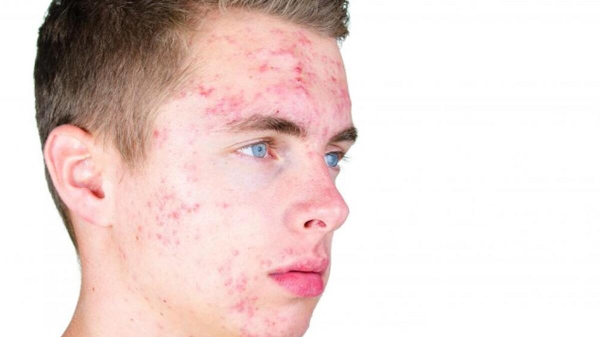 لا تسبب العادة السرية الأمراض الشائعة المذكورة حولها، كالعمى، أو حب الشباب، أو أي من الأمراض الجنسية بل ان احتمالية حدوث أمراض في في هذه الأعضاء تكون أكثر مع الجماع بين الزوجين، كما أن العادة السرية لا تؤثر على الدماغ ولا على نشاطه.