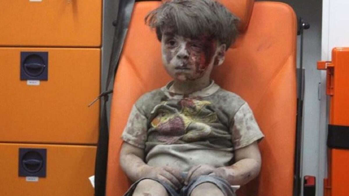 الطفل عمران (5 أعوام) تصدرت صورته وسائل الإعلام العالمية، وتم إنقاذه من تحت أنقاض أحد المباني المهدمة في المنطقة الشرقية لحلب في سوريا، وظهر عمران في الصورة شارداً مذهولاً وهو جالس على كرسي عربة الإسعاف.