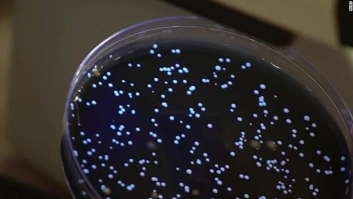 داء الفيالقة بسبب أحواض المياه الساخنة: يمكن لأحواض المياه الساخنة نشر الأمراض حتى من دون أن تدخلها، وهذا ما حدث في ولاية كارولينا الشمالية التي تفشى فيها داء الفيالقة المرتبط بالأحواض الساخنة وإصابة 140 شخص ووفاة 4 آخرين.