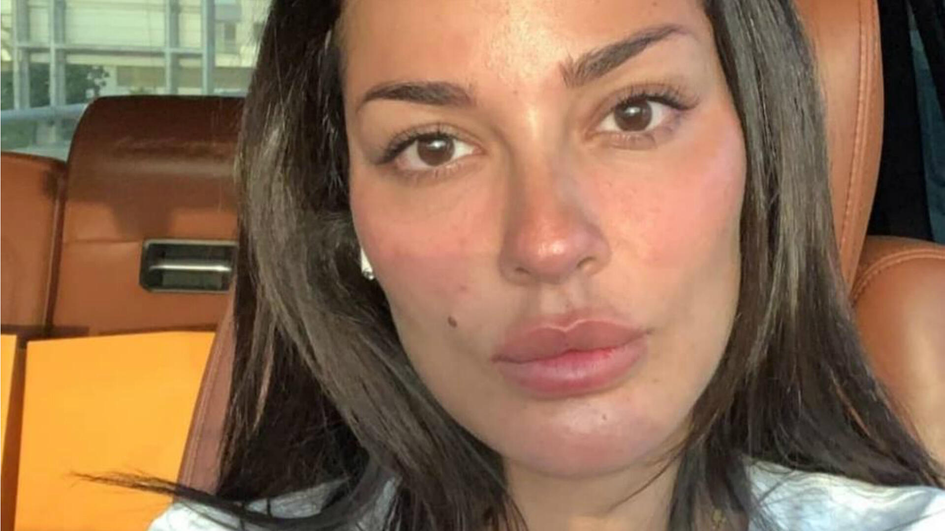Bold! Nadine Njeim Embraces Skin Flaws With NO MAKEUP Picture | Al Bawaba