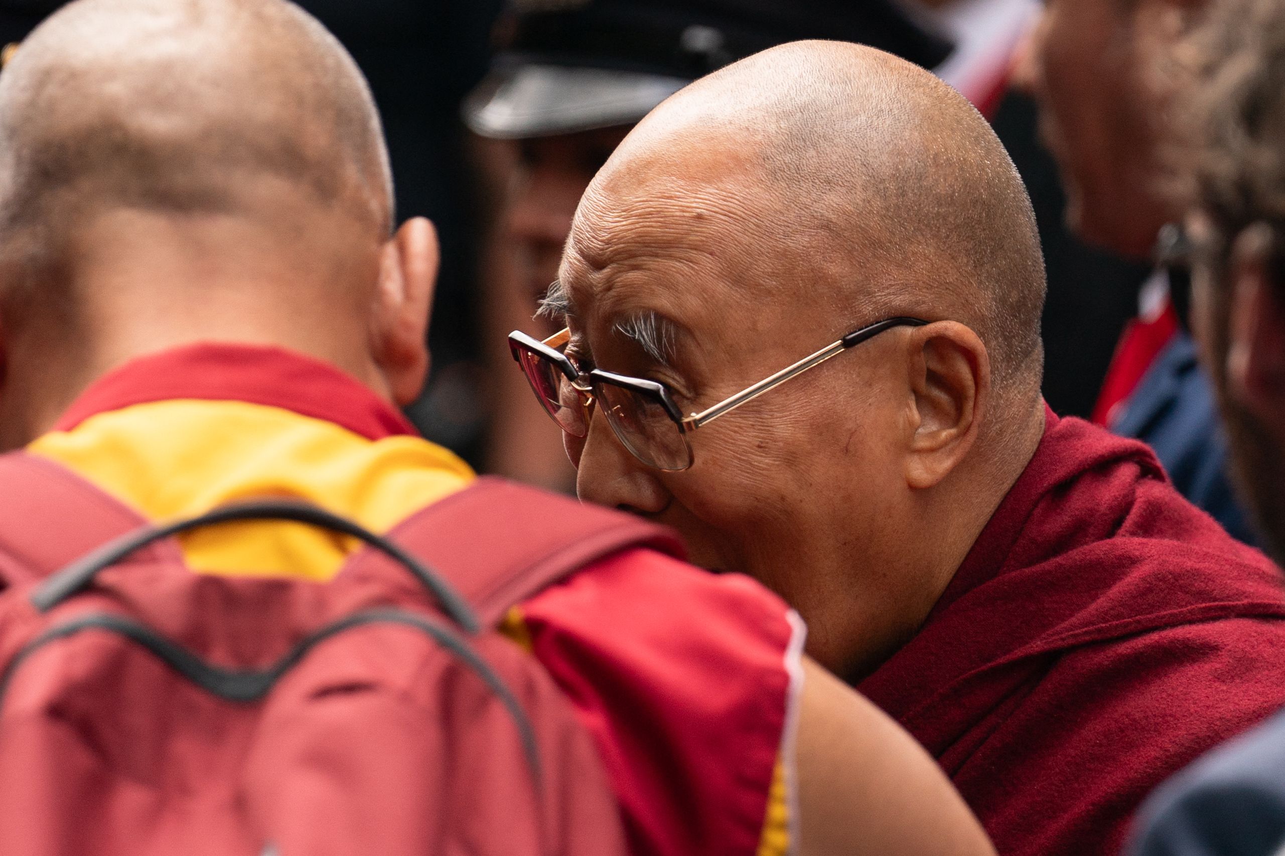 Has Lama Hasan'S Face Surgery Gone Too Far? - th3iqwu