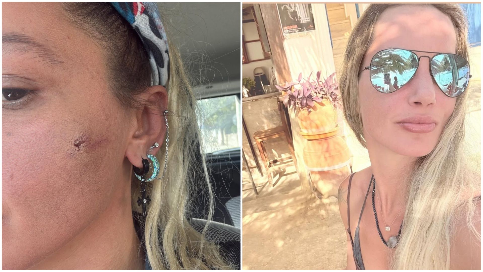 Turkish actress Yildiz Asyalı complains of violence by her husband