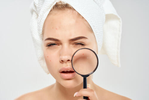 3 طرق طبيعية للتخلص من البقع البنية البوابة