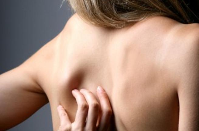 هل أنت مصابة بالأكزيما البوابة